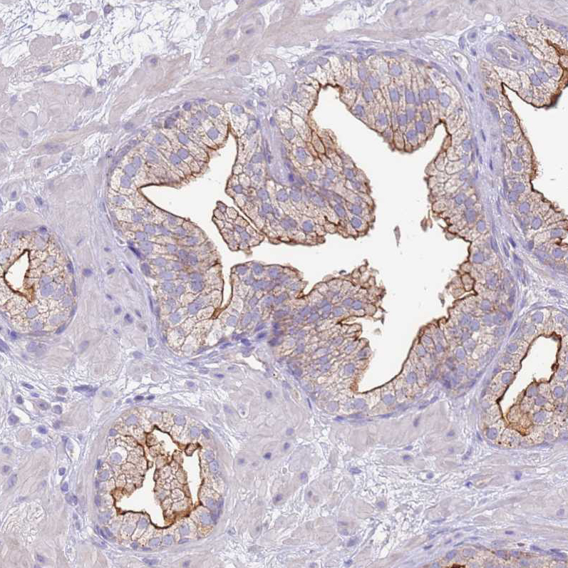 Immunohistochemistry (Formalin/PFA-fixed paraffin-embedded sections) - Anti-SLC44A4 antibody (AB188308), expandable thumbnail