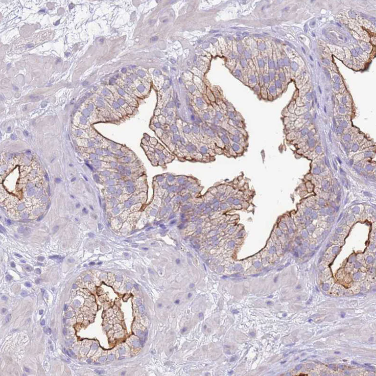 Immunohistochemistry (Formalin/PFA-fixed paraffin-embedded sections) - Anti-SLC44A4 antibody (AB188308)