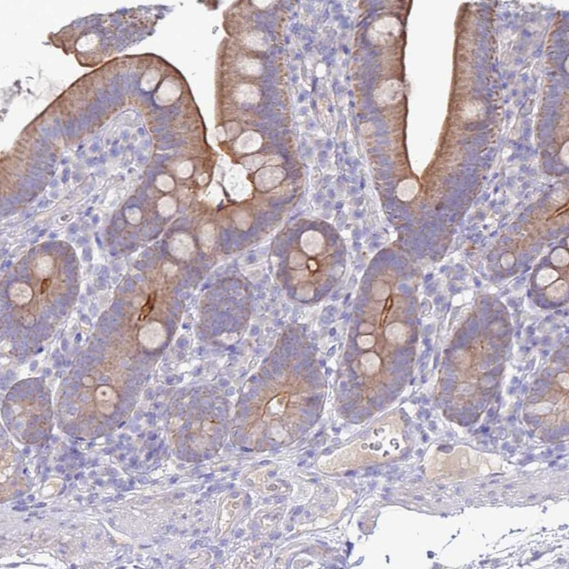 Immunohistochemistry (Formalin/PFA-fixed paraffin-embedded sections) - Anti-SLC44A4 antibody (AB188308), expandable thumbnail