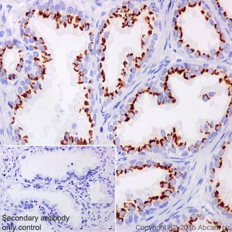 Immunohistochemistry (Formalin/PFA-fixed paraffin-embedded sections) - Anti-SLC45A3 antibody [EPR18068] (AB203827)