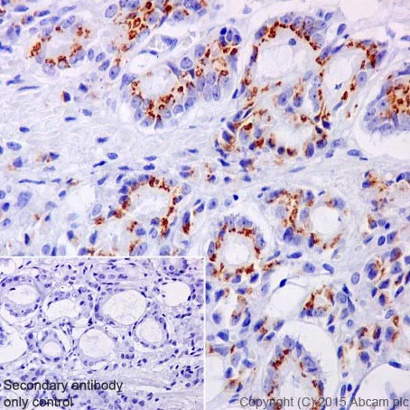 Immunohistochemistry (Formalin/PFA-fixed paraffin-embedded sections) - Anti-SLC45A3 antibody [EPR18068] - BSA and Azide free (AB251402)