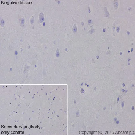 Immunohistochemistry (Formalin/PFA-fixed paraffin-embedded sections) - Anti-SLC45A3 antibody [EPR18068] - BSA and Azide free (AB251402)