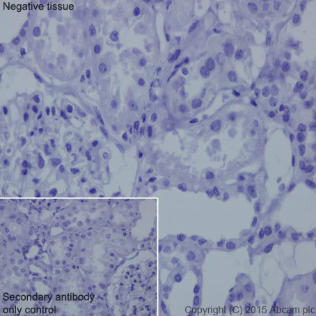 Immunohistochemistry (Formalin/PFA-fixed paraffin-embedded sections) - Anti-SLC45A3 antibody [EPR18068] - BSA and Azide free (AB251402)