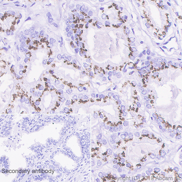 Immunohistochemistry (Formalin/PFA-fixed paraffin-embedded sections) - Anti-SLC45A3 antibody [EPR4795(2)] (AB137065)