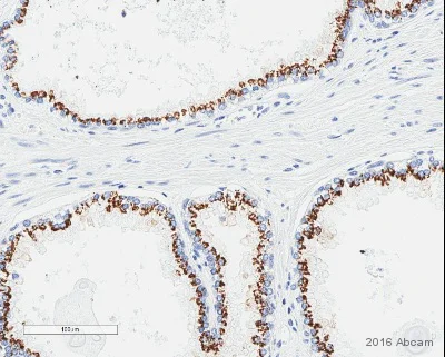 Immunohistochemistry (Formalin/PFA-fixed paraffin-embedded sections) - Anti-SLC45A3 antibody [EPR4795(2)] - BSA and Azide free (AB242056)