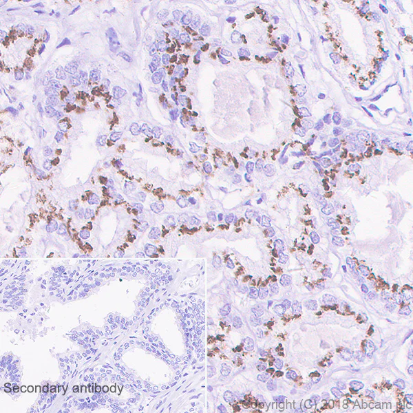 Immunohistochemistry (Formalin/PFA-fixed paraffin-embedded sections) - Anti-SLC45A3 antibody [EPR4795(2)] - BSA and Azide free (AB242056)