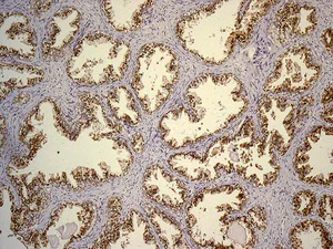 Immunohistochemistry (Formalin/PFA-fixed paraffin-embedded sections) - Anti-SLC45A3 antibody [EPR4795(2)] - BSA and Azide free (AB242056)