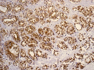 Immunohistochemistry (Formalin/PFA-fixed paraffin-embedded sections) - Anti-SLC45A3 antibody [EPR4795(2)] - BSA and Azide free (AB242056)