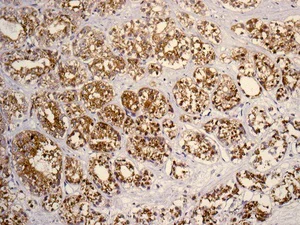 Immunohistochemistry (Formalin/PFA-fixed paraffin-embedded sections) - Anti-SLC45A3 antibody [EPR4795(2)] - BSA and Azide free (AB242056)