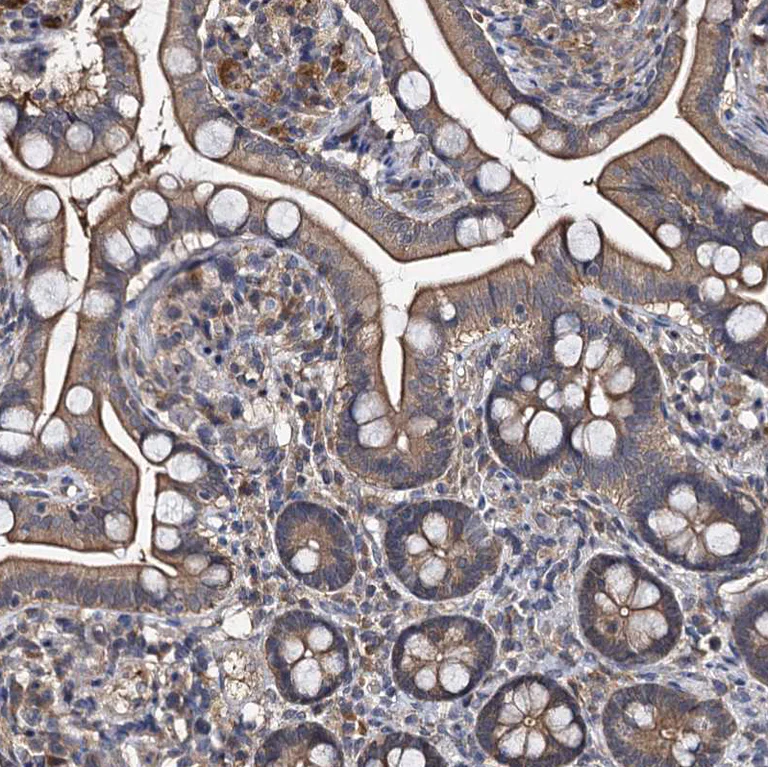 Immunohistochemistry (Formalin/PFA-fixed paraffin-embedded sections) - Anti-SLC46A3 antibody (AB243826)