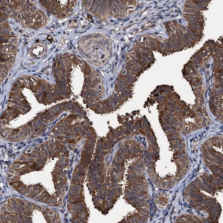 Immunohistochemistry (Formalin/PFA-fixed paraffin-embedded sections) - Anti-SLC46A3 antibody (AB243826)