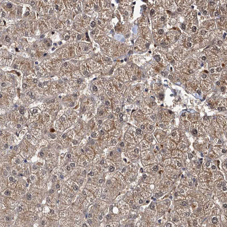 Immunohistochemistry (Formalin/PFA-fixed paraffin-embedded sections) - Anti-SLC46A3 antibody (AB243826)