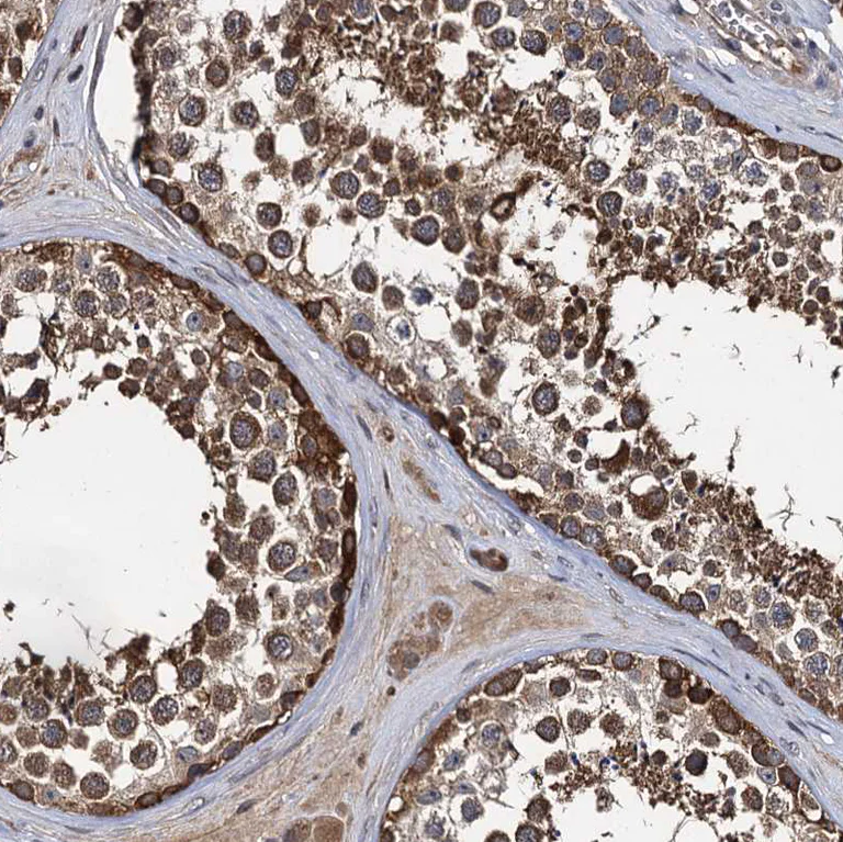 Immunohistochemistry (Formalin/PFA-fixed paraffin-embedded sections) - Anti-SLC46A3 antibody (AB243826)