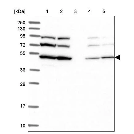 Western blot - Anti-SLC46A3 antibody (AB243826)