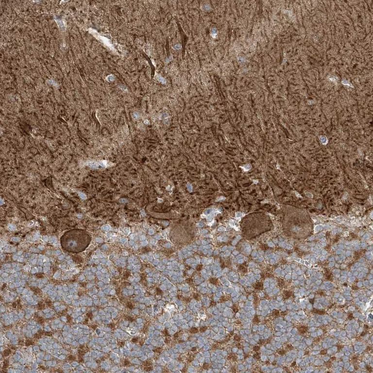 Immunohistochemistry (Formalin/PFA-fixed paraffin-embedded sections) - Anti-SLC4A10 antibody (AB122229)