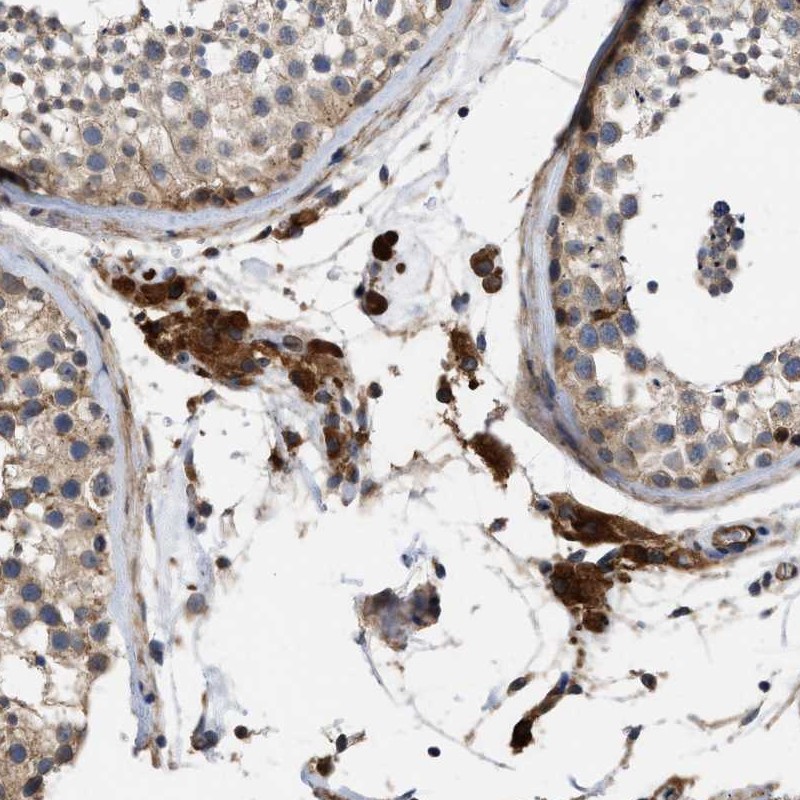 Immunohistochemistry (Formalin/PFA-fixed paraffin-embedded sections) - Anti-SLC4A11 antibody (AB251719), expandable thumbnail