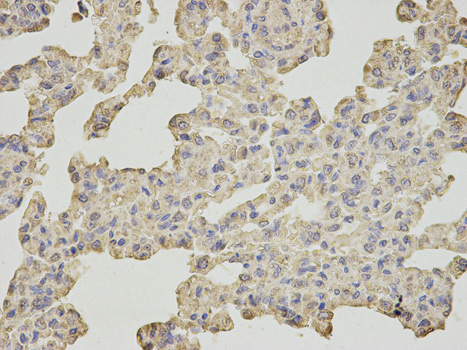 Immunohistochemistry (Formalin/PFA-fixed paraffin-embedded sections) - Anti-SLC4A4/NBC antibody (AB187511), expandable thumbnail