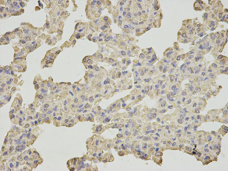 Immunohistochemistry (Formalin/PFA-fixed paraffin-embedded sections) - Anti-SLC4A4/NBC antibody (AB187511)