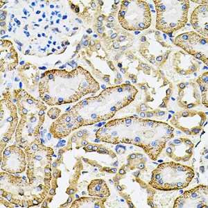 Immunohistochemistry (Formalin/PFA-fixed paraffin-embedded sections) - Anti-SLC4A4/NBC antibody (AB187511)