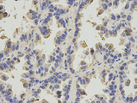 Immunohistochemistry (Formalin/PFA-fixed paraffin-embedded sections) - Anti-SLC4A4/NBC antibody (AB187511), expandable thumbnail