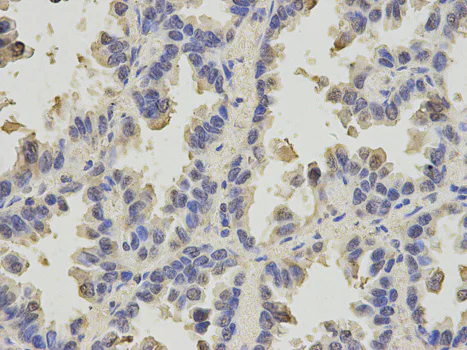 Immunohistochemistry (Formalin/PFA-fixed paraffin-embedded sections) - Anti-SLC4A4/NBC antibody (AB187511)