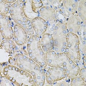 Immunohistochemistry (Formalin/PFA-fixed paraffin-embedded sections) - Anti-SLC4A4/NBC antibody (AB187511), expandable thumbnail