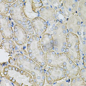 Immunohistochemistry (Formalin/PFA-fixed paraffin-embedded sections) - Anti-SLC4A4/NBC antibody (AB187511)