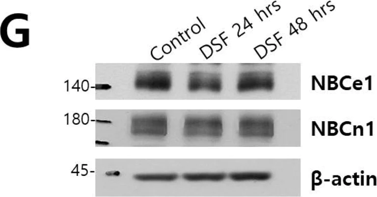 Western blot - Anti-SLC4A4/NBC antibody (AB187511)