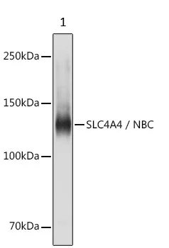 Western blot - Anti-SLC4A4/NBC antibody (AB187511)