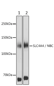 Western blot - Anti-SLC4A4/NBC antibody (AB187511)