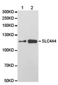 Western blot - Anti-SLC4A4/NBC antibody (AB187511)