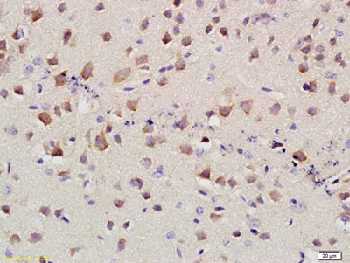 Immunohistochemistry (Formalin/PFA-fixed paraffin-embedded sections) - Anti-SLC4A4/NBC antibody (AB217352)