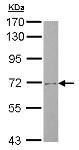 Western blot - Anti-SLC4A8/NBC antibody (AB125910), expandable thumbnail