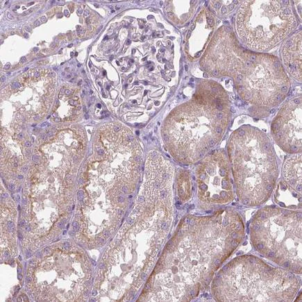 Immunohistochemistry (Formalin/PFA-fixed paraffin-embedded sections) - Anti-SLC51B antibody (AB121285)