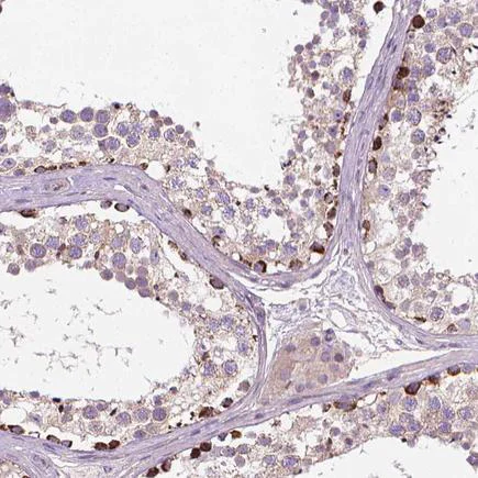 Immunohistochemistry (Formalin/PFA-fixed paraffin-embedded sections) - Anti-SLC51B antibody (AB121285)