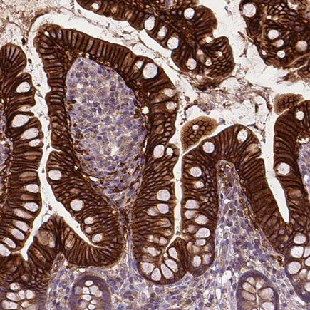 Immunohistochemistry (Formalin/PFA-fixed paraffin-embedded sections) - Anti-SLC51B antibody (AB121285)