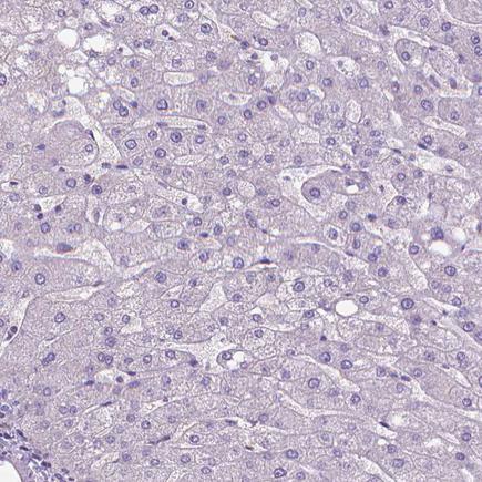 Immunohistochemistry (Formalin/PFA-fixed paraffin-embedded sections) - Anti-SLC51B antibody (AB121285)