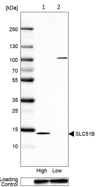 Western blot - Anti-SLC51B antibody (AB121285)