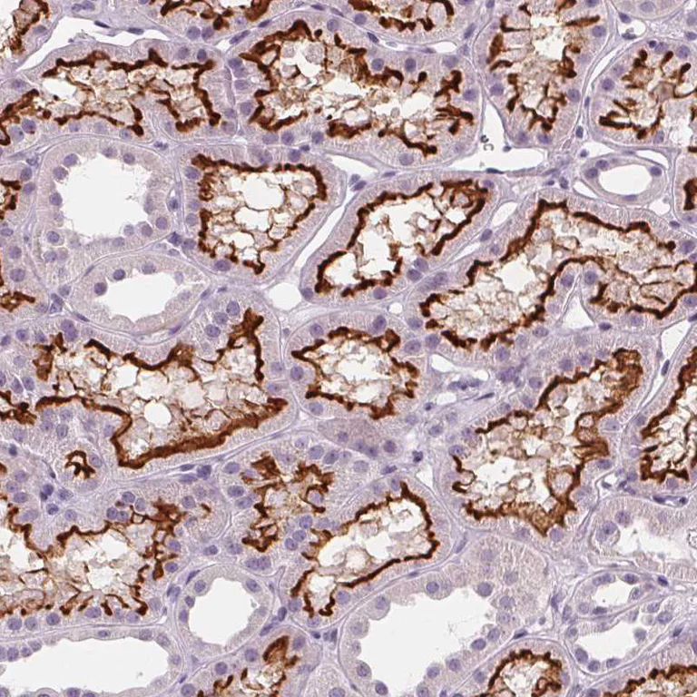 Immunohistochemistry (Formalin/PFA-fixed paraffin-embedded sections) - Anti-SLC5A12 antibody (AB262934)