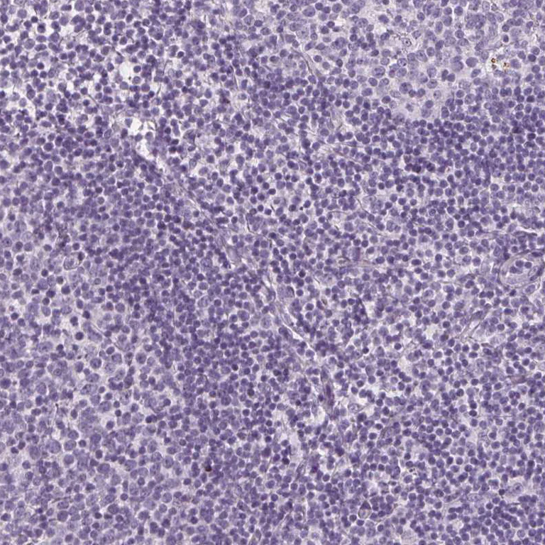 Immunohistochemistry (Formalin/PFA-fixed paraffin-embedded sections) - Anti-SLC5A12 antibody (AB262934)