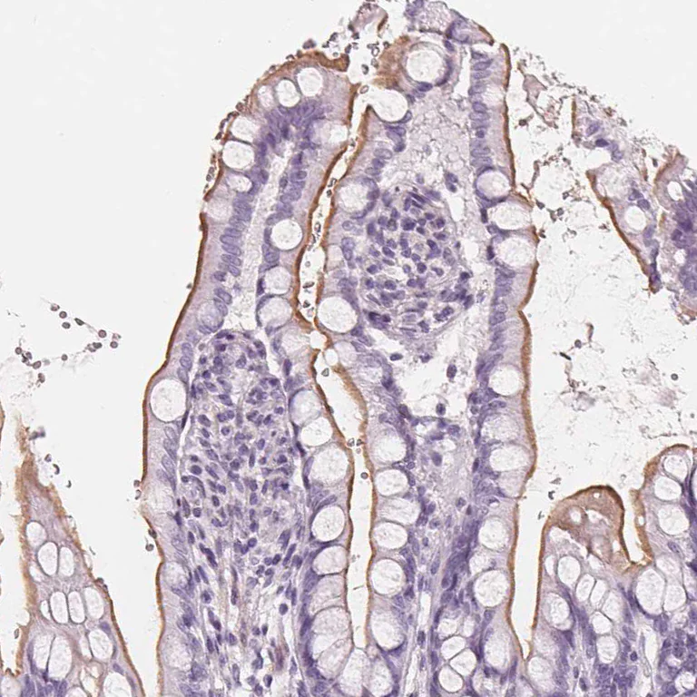 Immunohistochemistry (Formalin/PFA-fixed paraffin-embedded sections) - Anti-SLC5A12 antibody (AB262934)