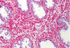Immunohistochemistry (Formalin/PFA-fixed paraffin-embedded sections) - Anti-SLC5A3 antibody (AB113245)