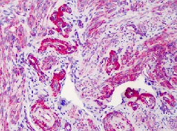 Immunohistochemistry (Formalin/PFA-fixed paraffin-embedded sections) - Anti-SLC5A3 antibody (AB113245)