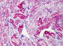 Immunohistochemistry (Formalin/PFA-fixed paraffin-embedded sections) - Anti-SLC5A3 antibody (AB113245)