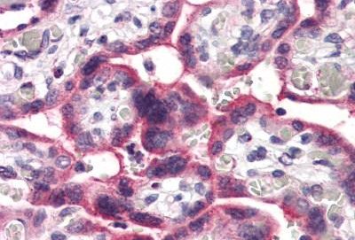 Immunohistochemistry (Formalin/PFA-fixed paraffin-embedded sections) - Anti-SLC5A6 antibody (AB140974)