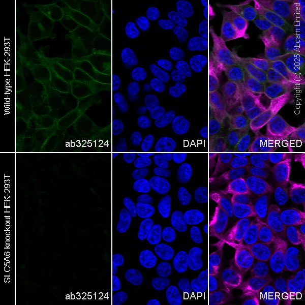 Immunocytochemistry/ Immunofluorescence - Anti-SLC5A6 antibody [EPR30529-531] - BSA and Azide free (AB325142)