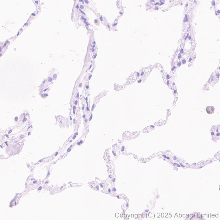 Immunohistochemistry (Formalin/PFA-fixed paraffin-embedded sections) - Anti-SLC5A6 antibody [EPR30529-531] - BSA and Azide free (AB325142)