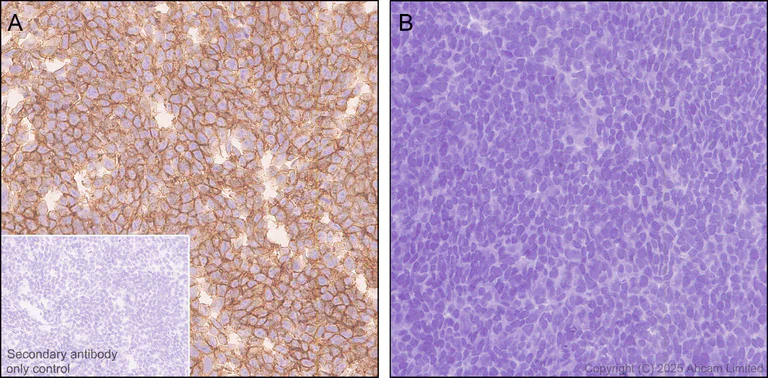 Immunohistochemistry (Formalin/PFA-fixed paraffin-embedded sections) - Anti-SLC5A6 antibody [EPR30529-531] - BSA and Azide free (AB325142)