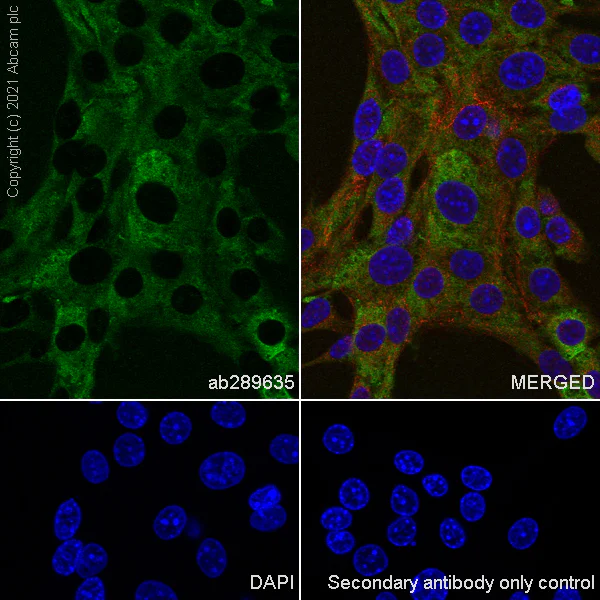 Immunocytochemistry/ Immunofluorescence - Anti-SLC5A7 antibody [EPR25152-16] (AB289635)