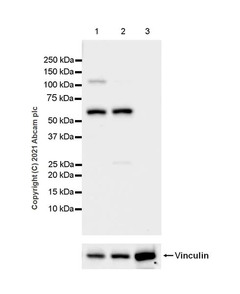 Western blot - Anti-SLC5A7 antibody [EPR25152-16] - BSA and Azide free (AB289637)